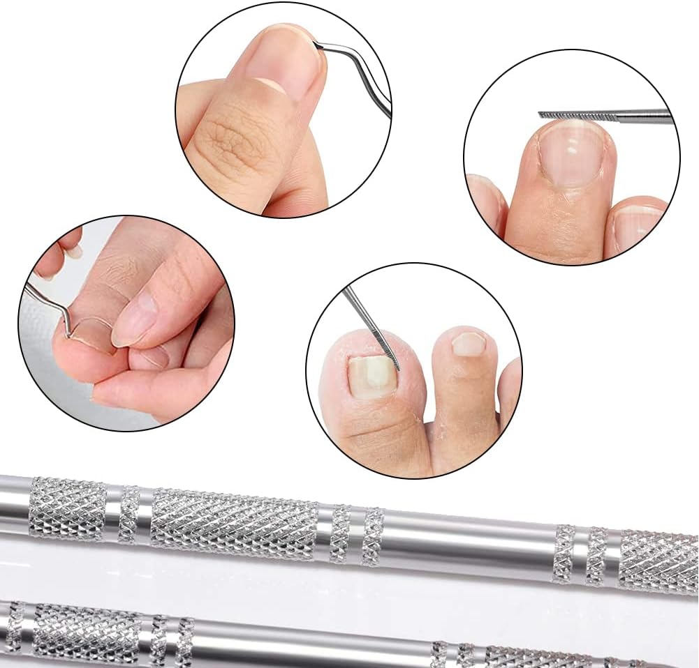 Eckenheber - Ein vielseitiges Werkzeug für die Nagelpflege